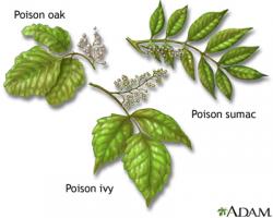 Identifying Poison Plants